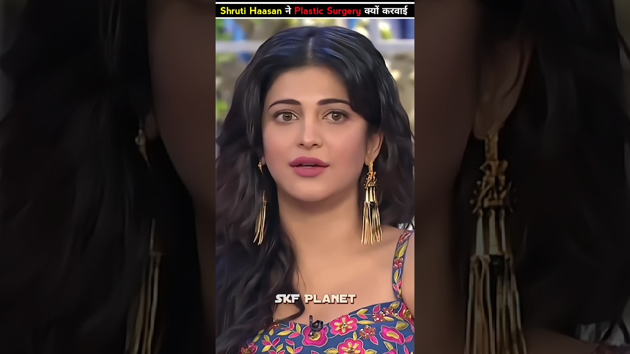Shruti Haasan ने Plastic Surgery क्यों करवाई By SKF Planet