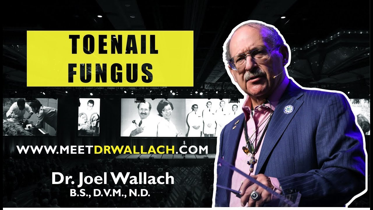 TOENAIL FUNGUS - DR. JOEL WALLACH