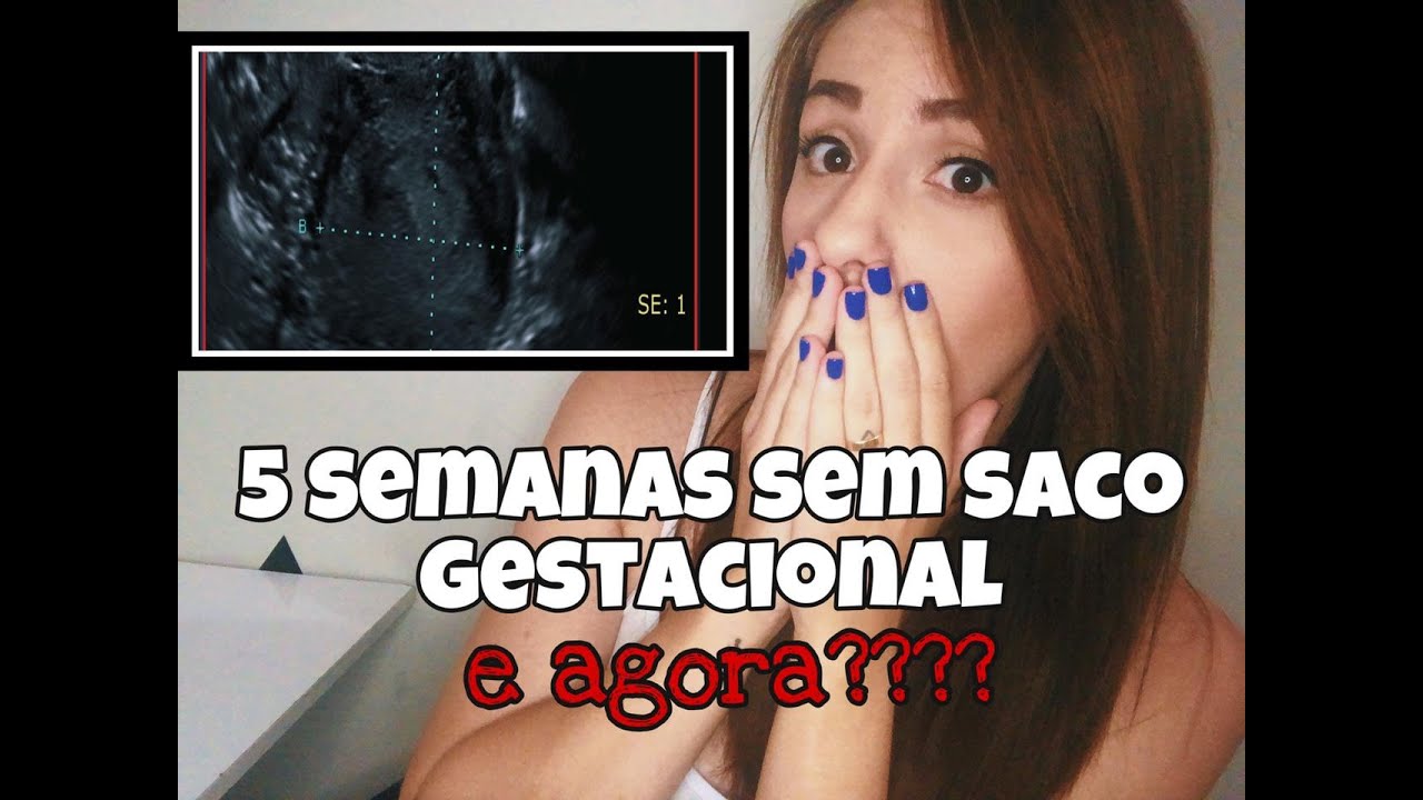 Não vi o saco gestacional, e agora?