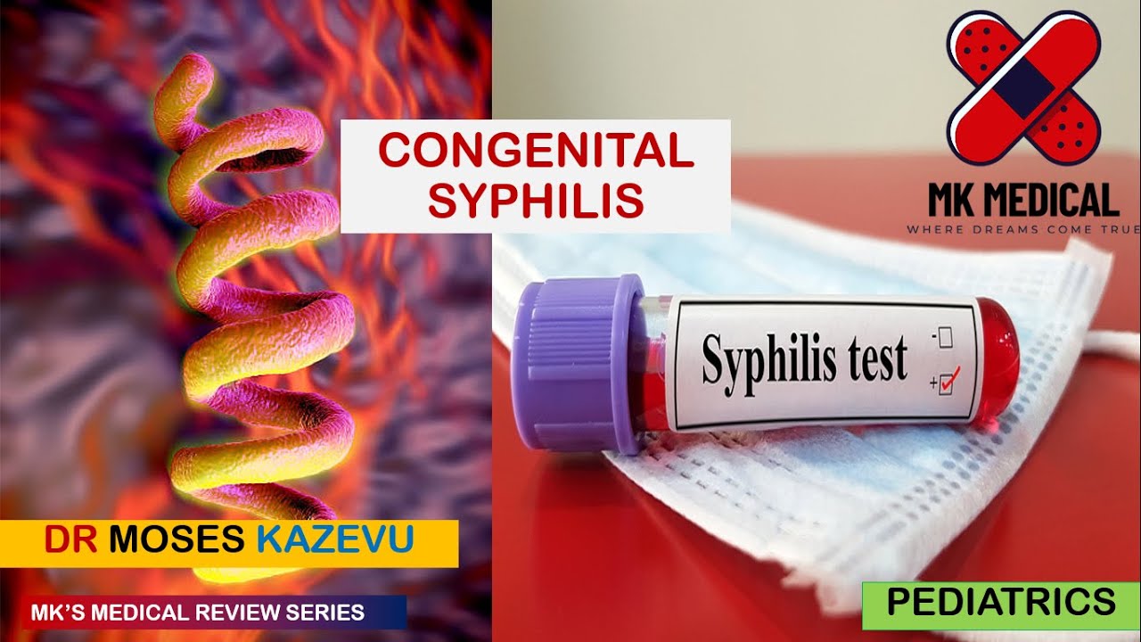 Congenital Syphilis || Congenital Louis