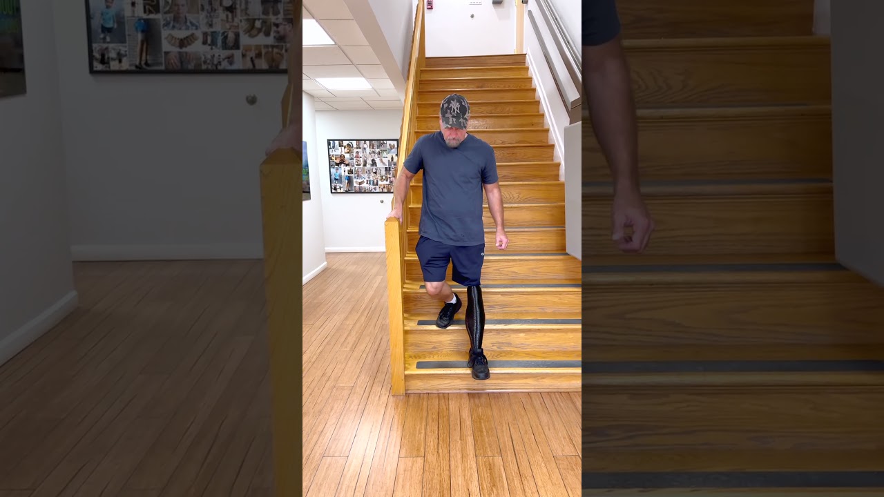 Richard&rsquo;s Osseointegration Journey | Walking with Above-Knee Prosthesis