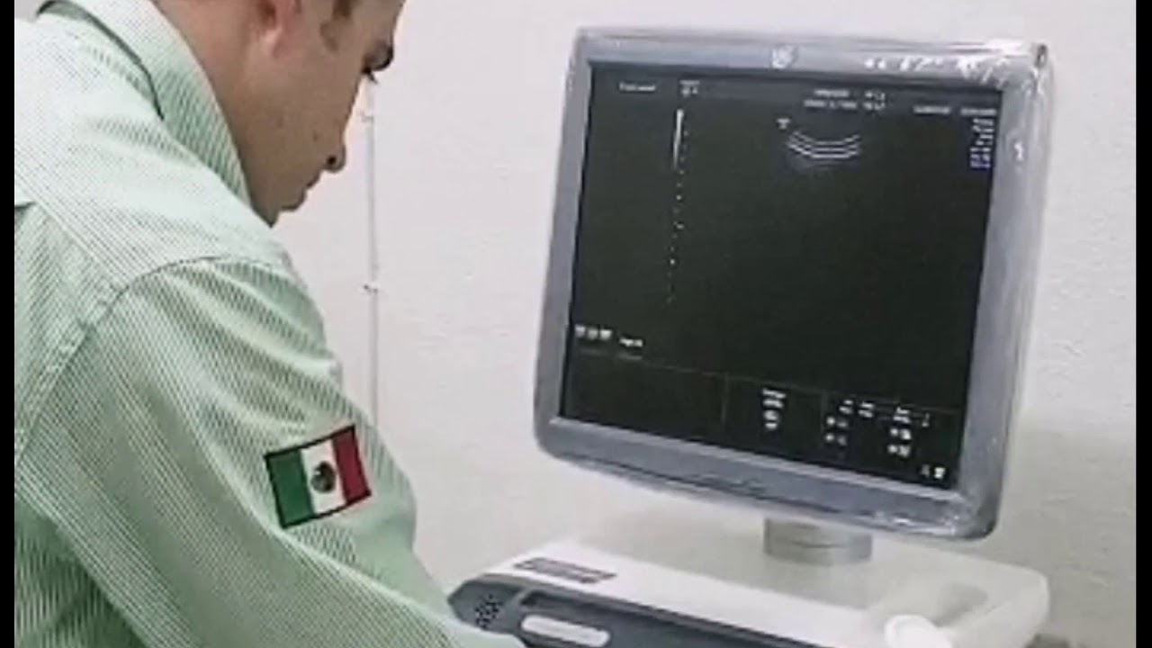 GE Voluson E6  detalles técnicos.