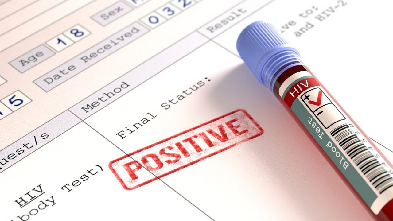 Így terjed a HIV-fertőzés | HáziPatika