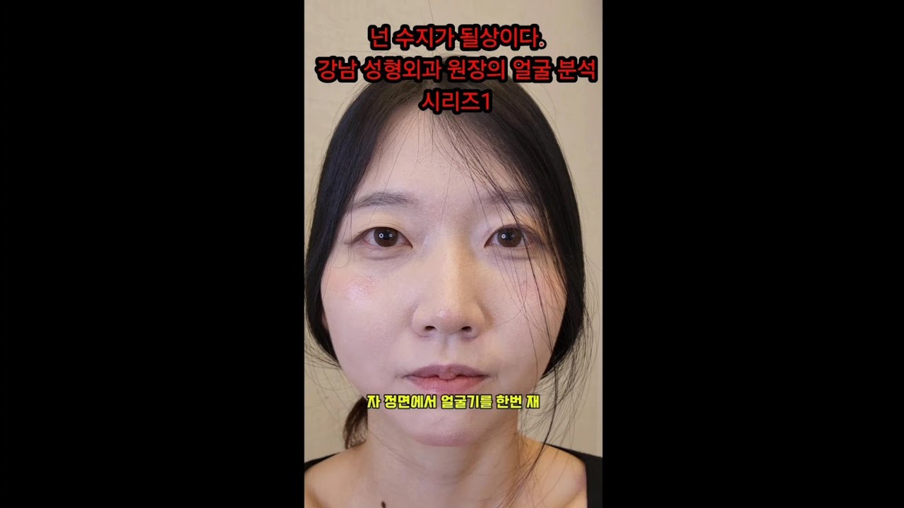 넌 수지가 될 상이다. 강남성형외과 의사의 얼굴분석. #광대축소#코성형#수지#얼굴분석#중안부#회전입매 #양악