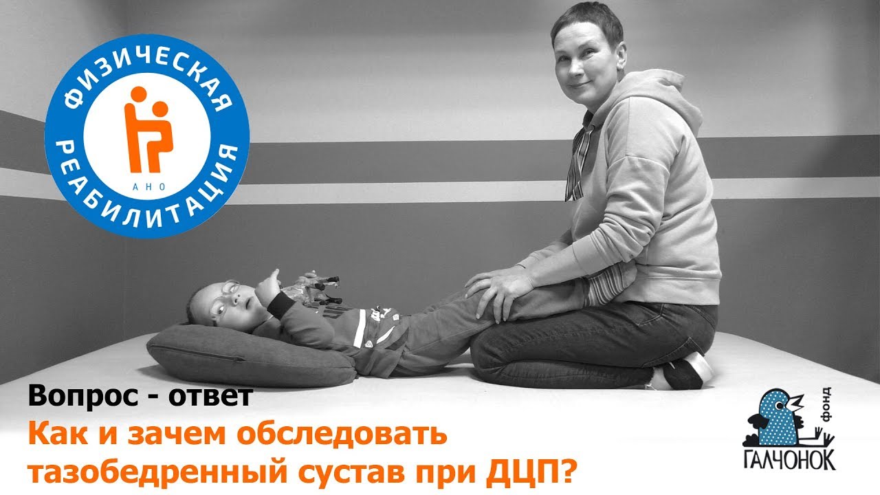 Как и зачем обследовать тазобедренный сустав при ДЦП?