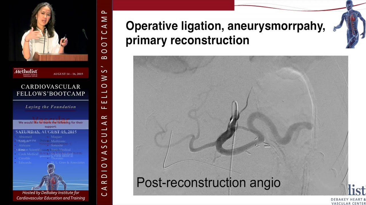 Management of Visceral Artery Aneurysms (Tam Huynh, MD)