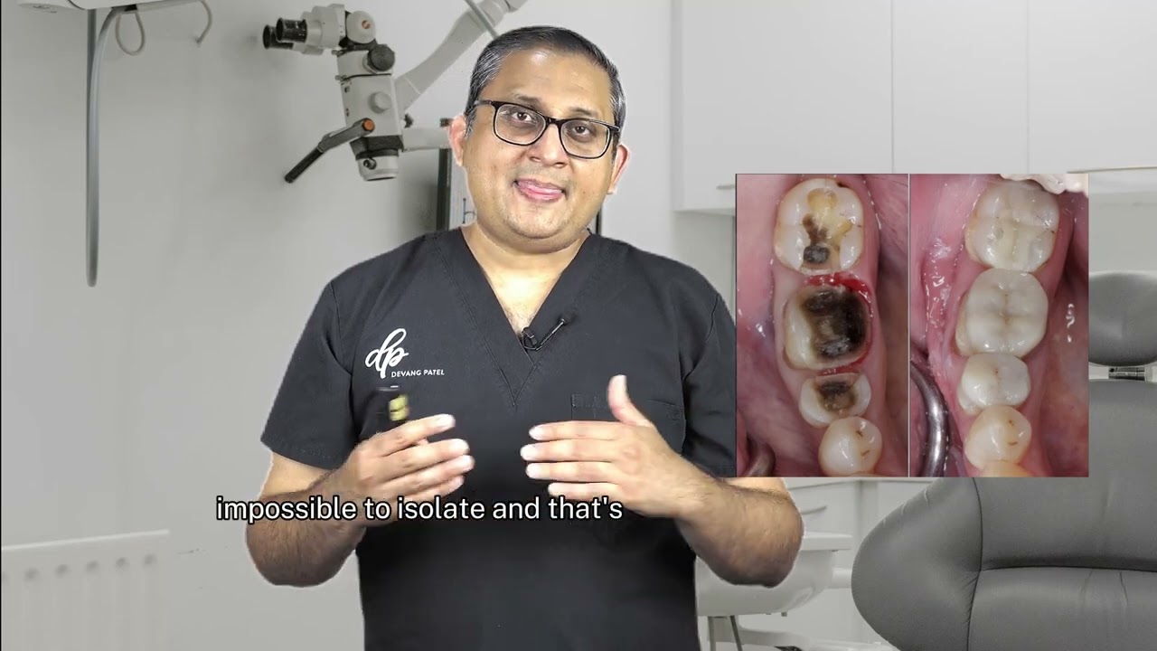 Deep Margin Elevation (DME) Technique: Why It's Essential for Elevating Your Practice | 3 Tips