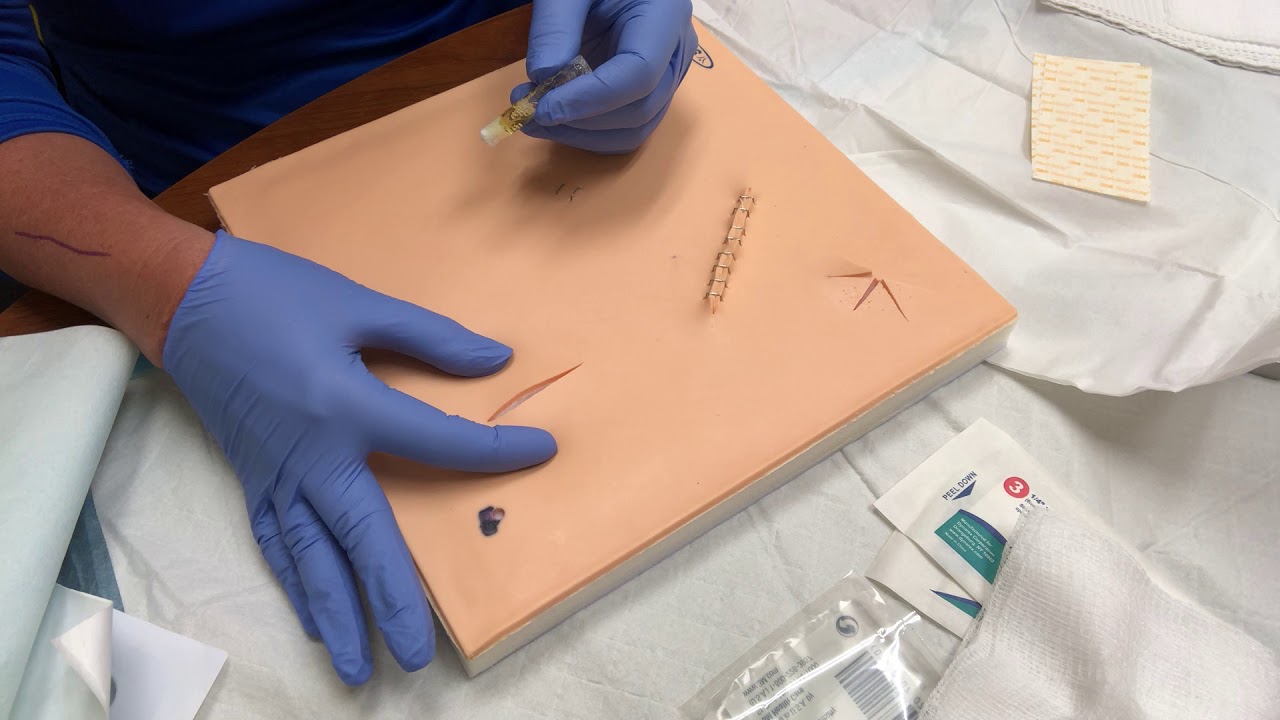 Steri-Strip Application