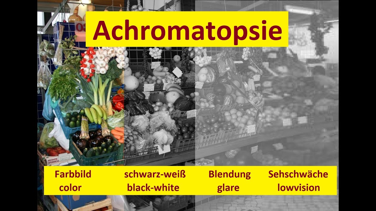 Achromatopsie - viel mehr als farbenblind