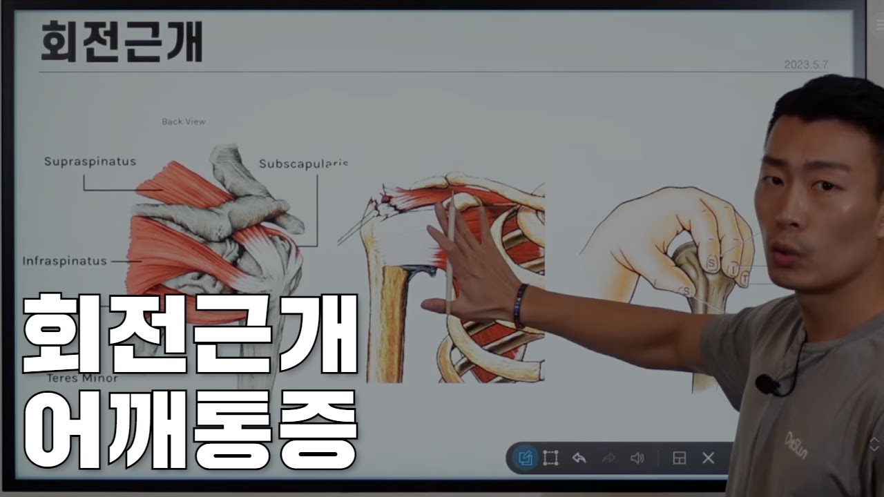 어깨 뒤쪽 통증 극하근을 의심해보세요.