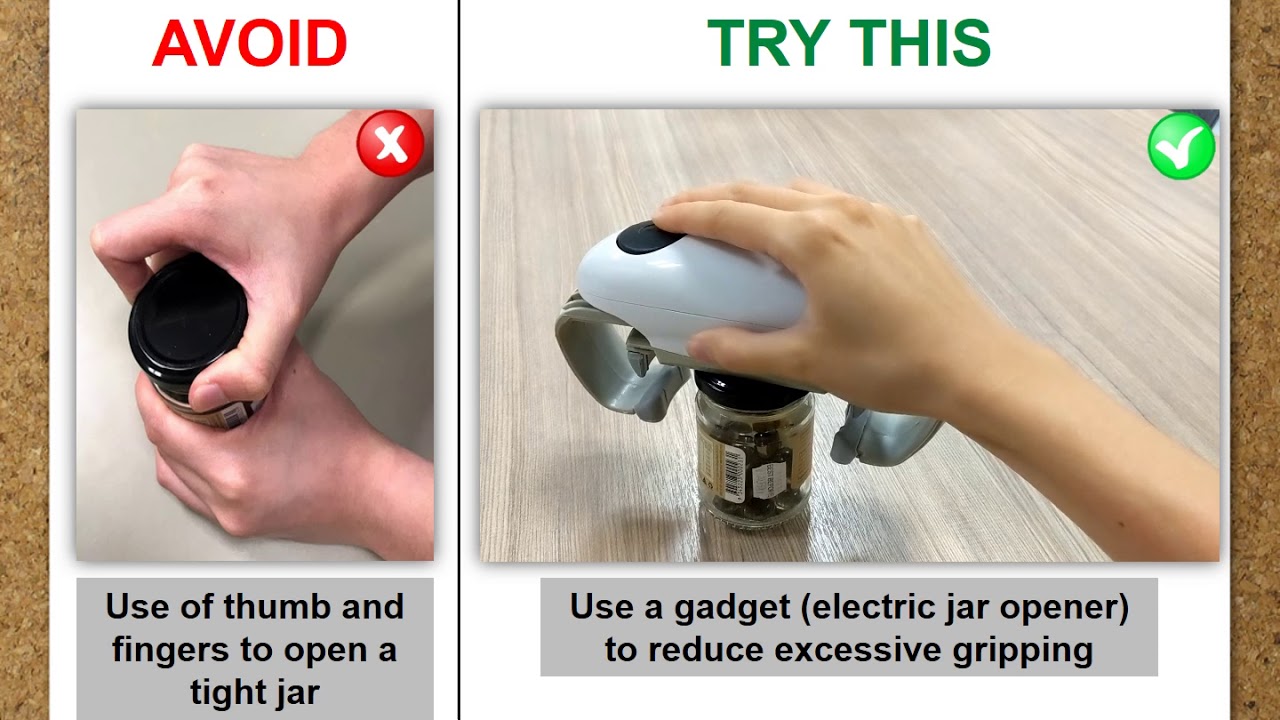 NUH Occupational Therapy - Management of Trigger Finger (Activity Modification)