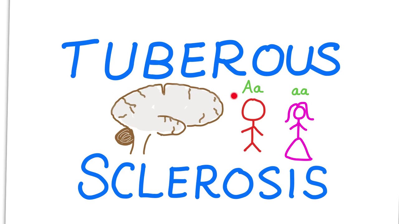 Tuberous Sclerosis Complex (TSC)