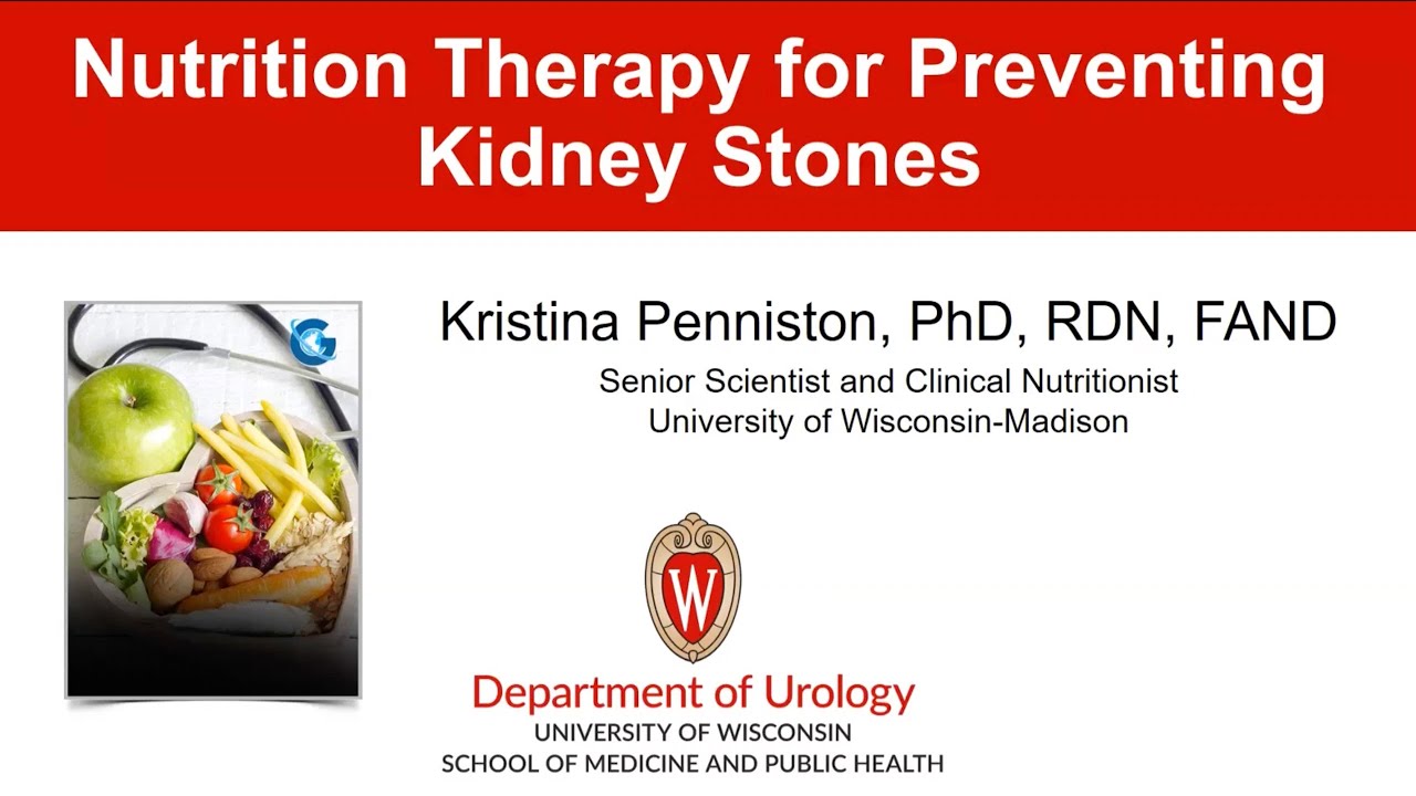 UW Urology Grand Rounds: Prevention of Urolithiasis with Diet &ndash; 1/18/2023