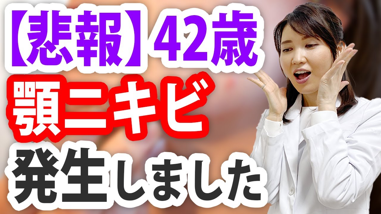 皮膚科医が自分のニキビをどう治療するか公開します。