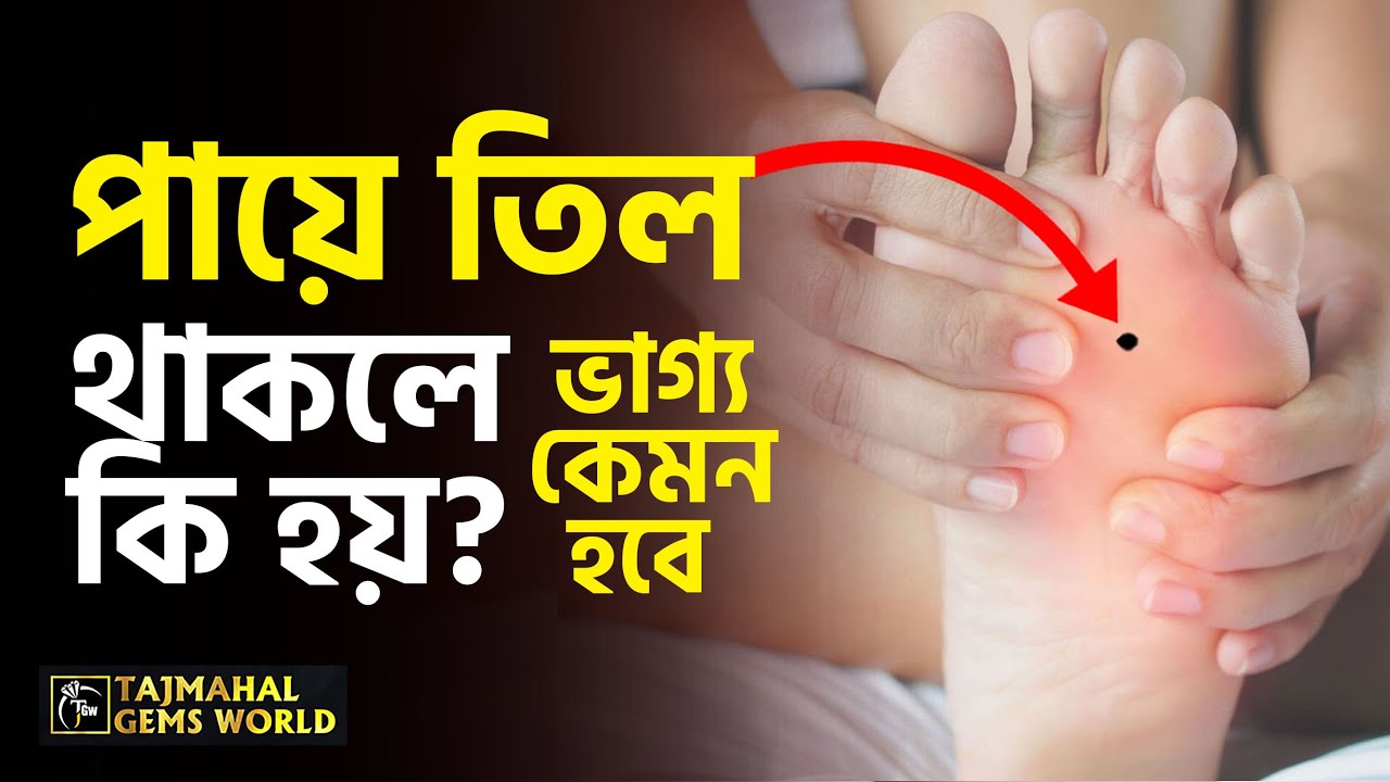 পায়ে তিল থাকলে কি হয় তিল চিহ্ন থেকে ভাগ্য বিচার