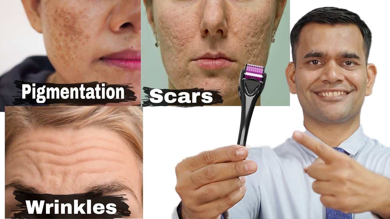Reduce Wrinkles, Darkspots, Fine lines and Boost Collagen Naturally at Home