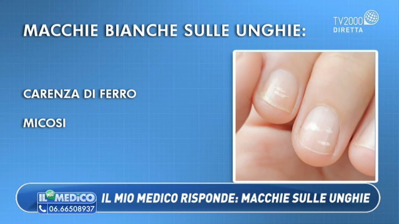 Il Mio Medico - Macchie sulle unghie, idratazione, sangue dal naso