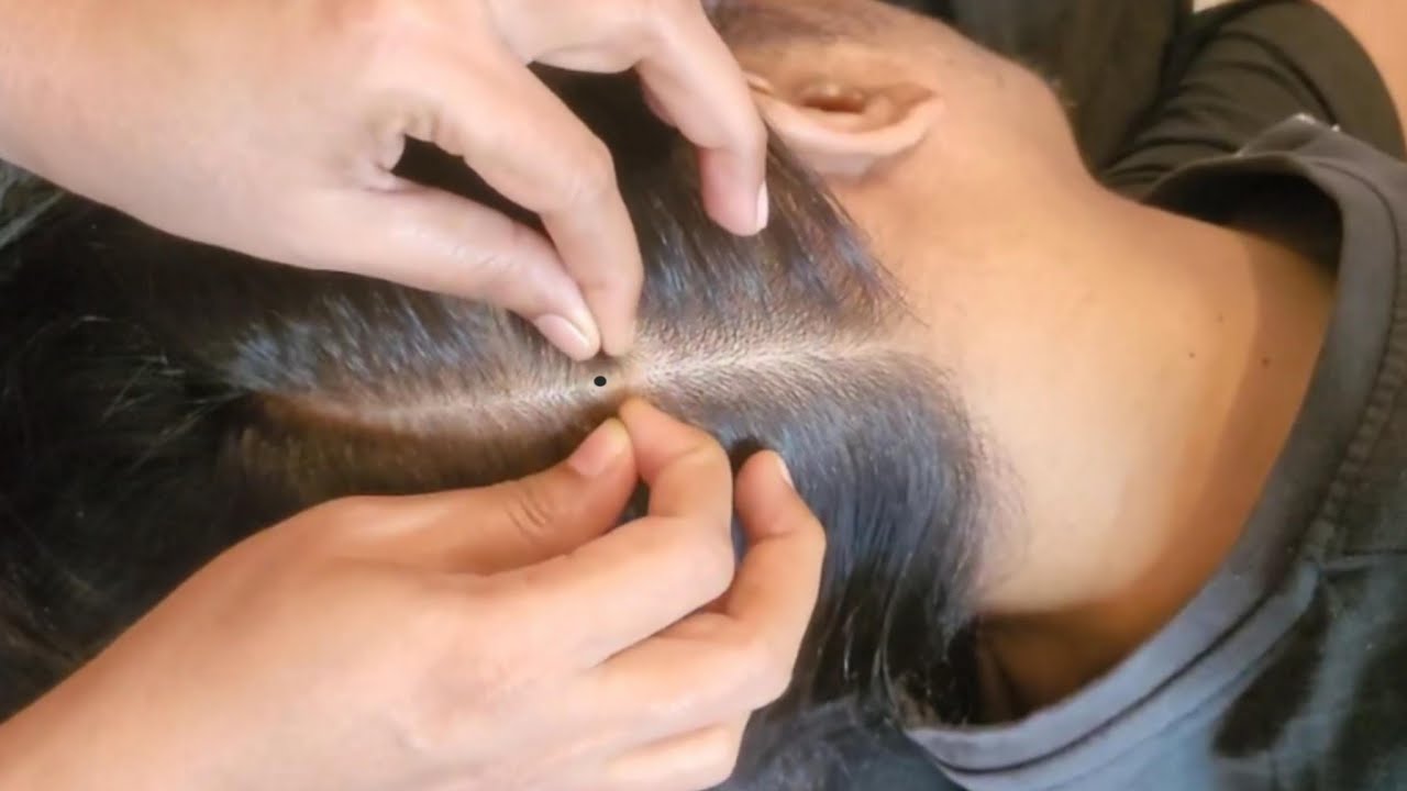 Scalp Check ASMR - Personal Attention Sleep Therapy