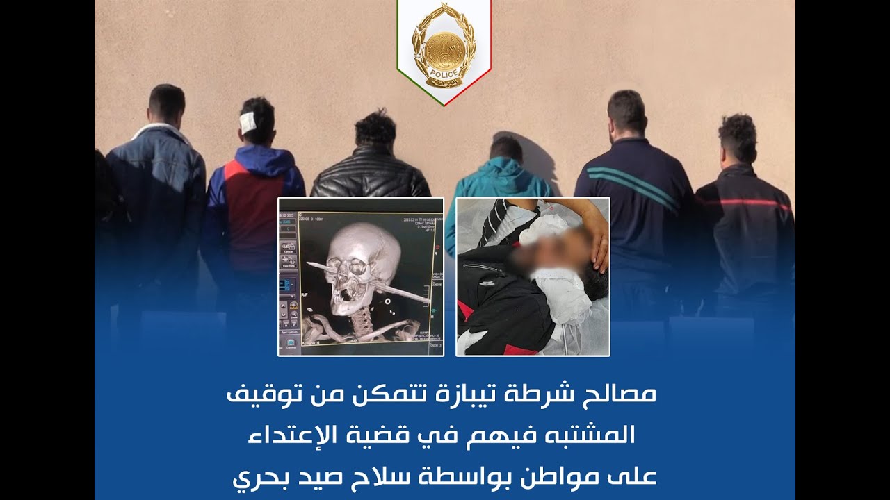 أمن ولاية تيبازة : توقيف المتورطين الذين إعتدوا على شخص ببندقية صيد