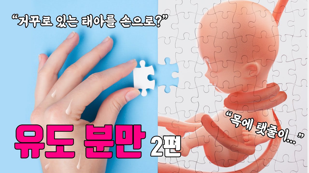 유도분만 그리고 자연분만에 대한 마지막 영상 (둔위회전술) | 여성건강채널_No.1