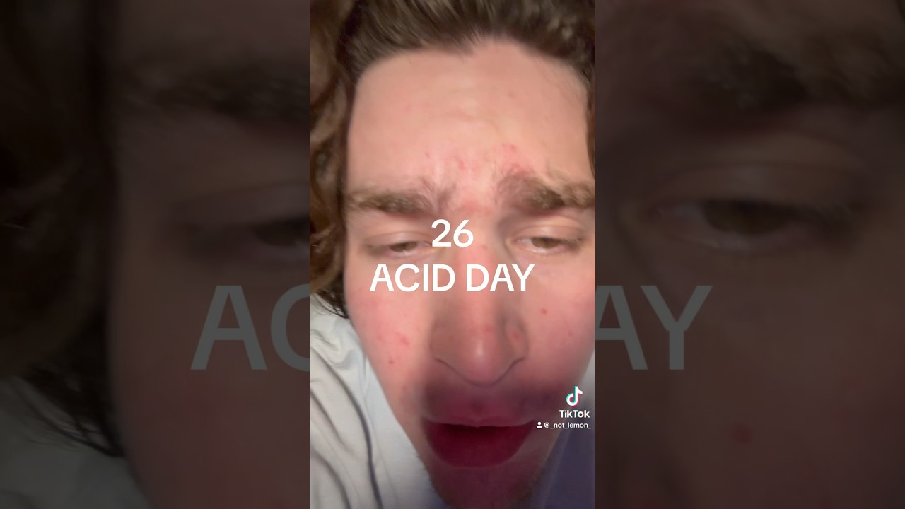 26 ACID DAY 🍋#acidmusic #новыйстиль #музыка #новыйжанр #рэпер #битмэйкер #новаямузыка #новыйрэп