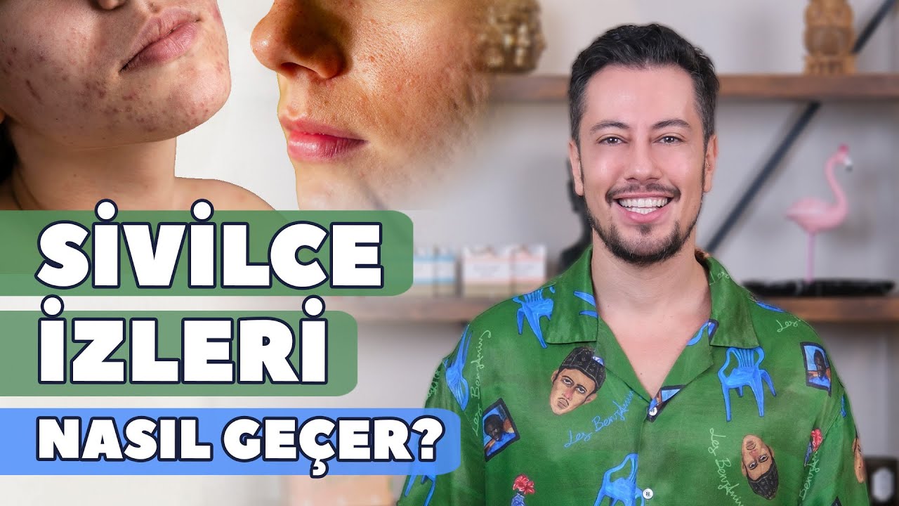 Sivilce İzleri Nasıl Geçer?