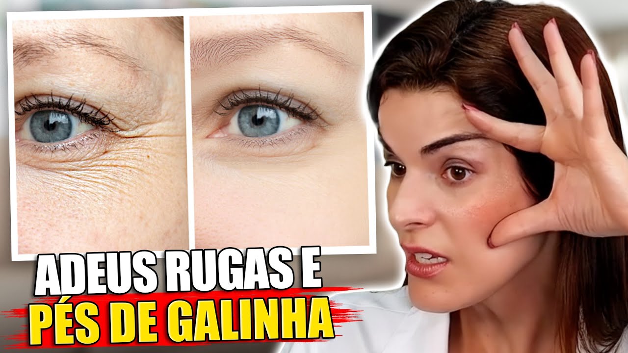 RUGAS e PÉS DE GALINHA Nunca Mais! ❌