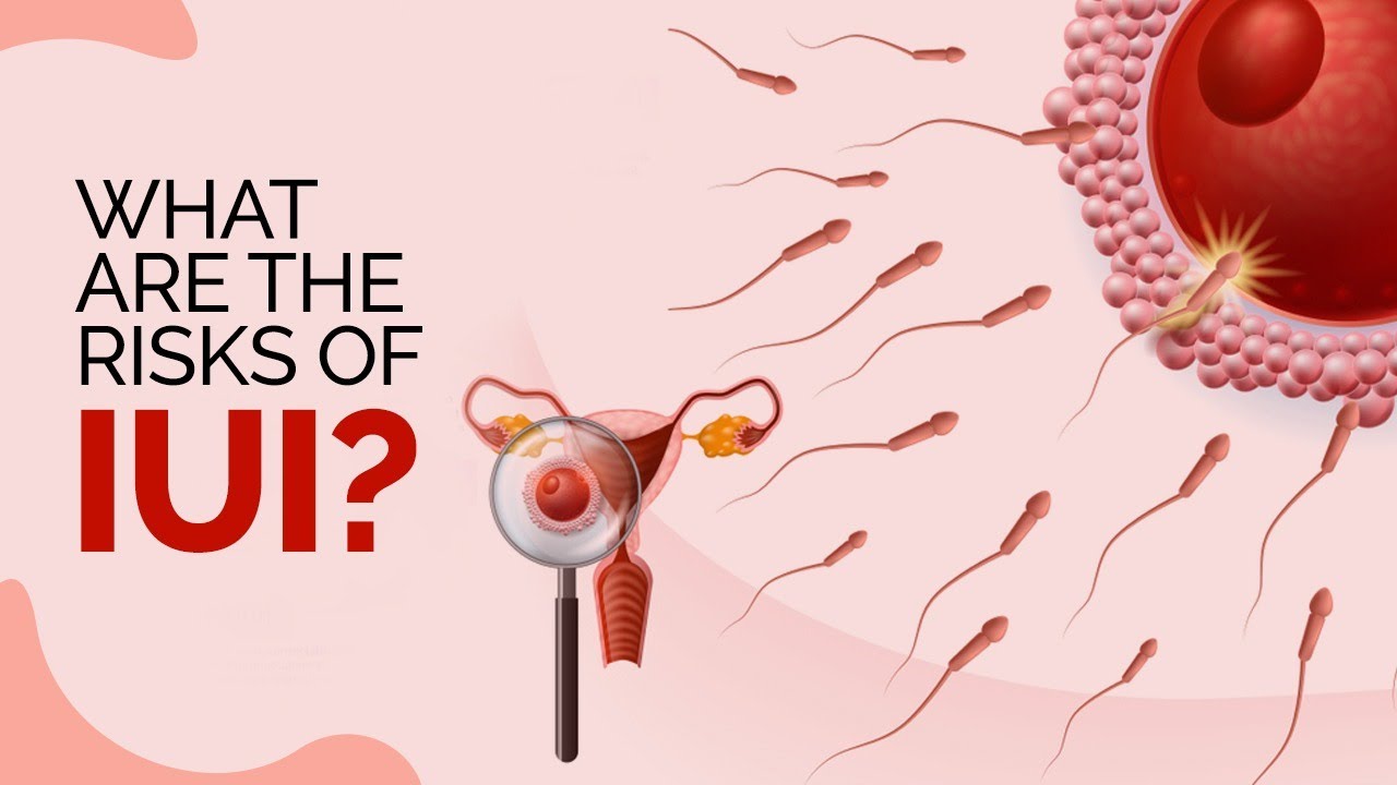 How does IUI work? What are the risks of IUI?