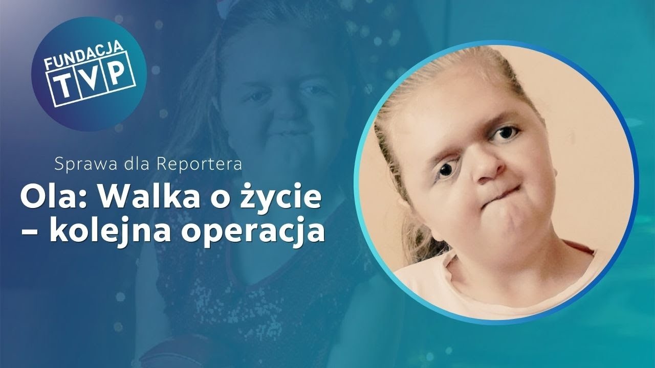 Ola z zespołem Aperta potrzebuje pomocy – kolejna operacja to jej jedyna szansa