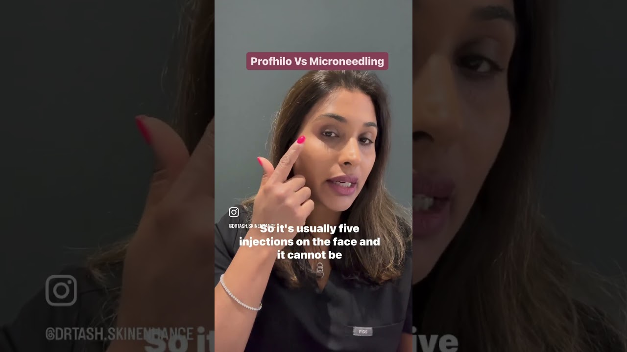 Whats the difference between Profhilo and Microneedling?