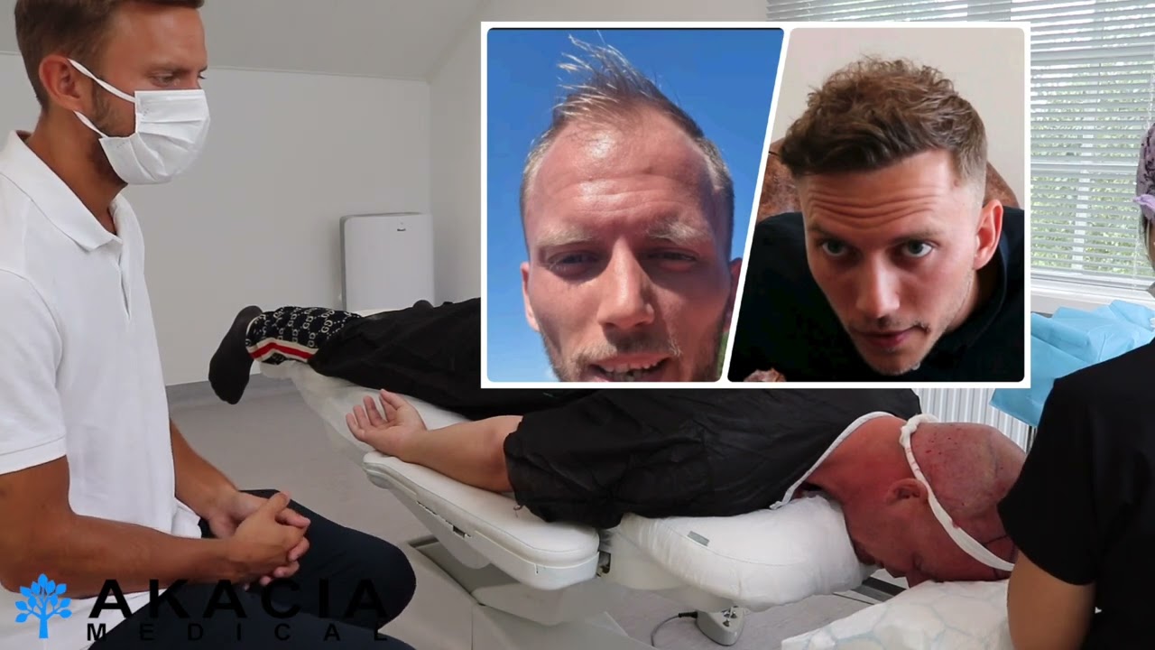 Hur ont gör en hårtransplantation?