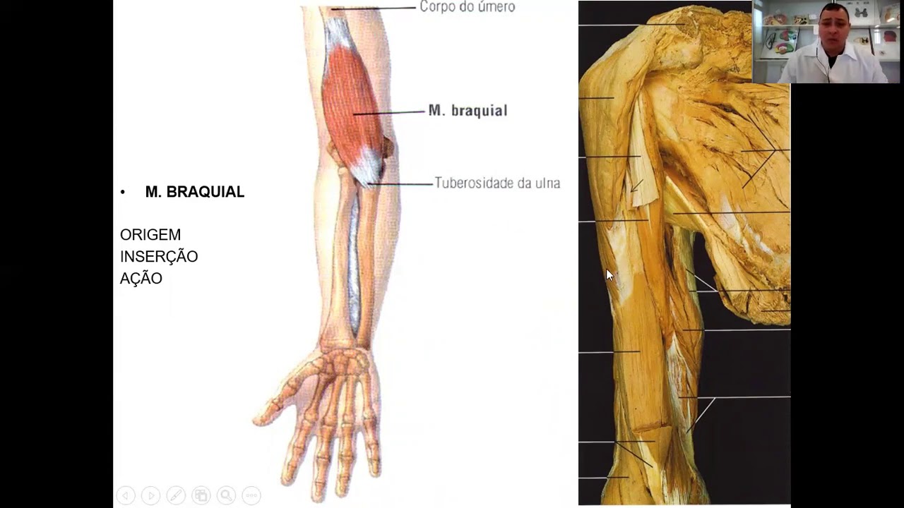 VÍDEO AULA TEÓRICA MÚSCULOS DO BRAÇO