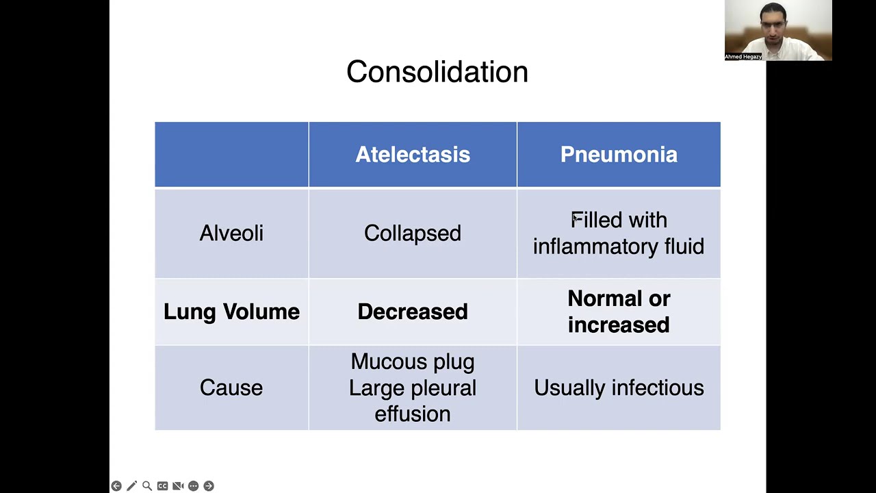 Point-of-care Ultrasound Differentiation of Pneumonia versus Atelectasis