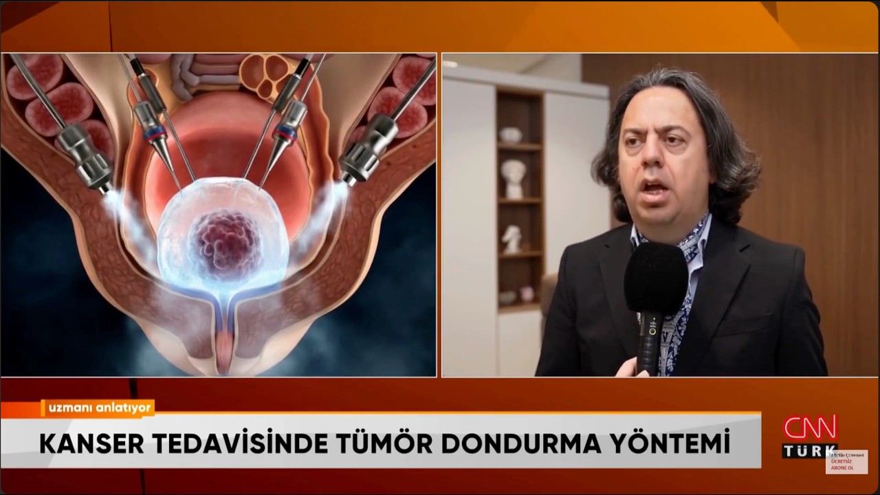 Kanserde Kriyoablasyon Tedavisi (Dondurma y&ouml;ntemi)