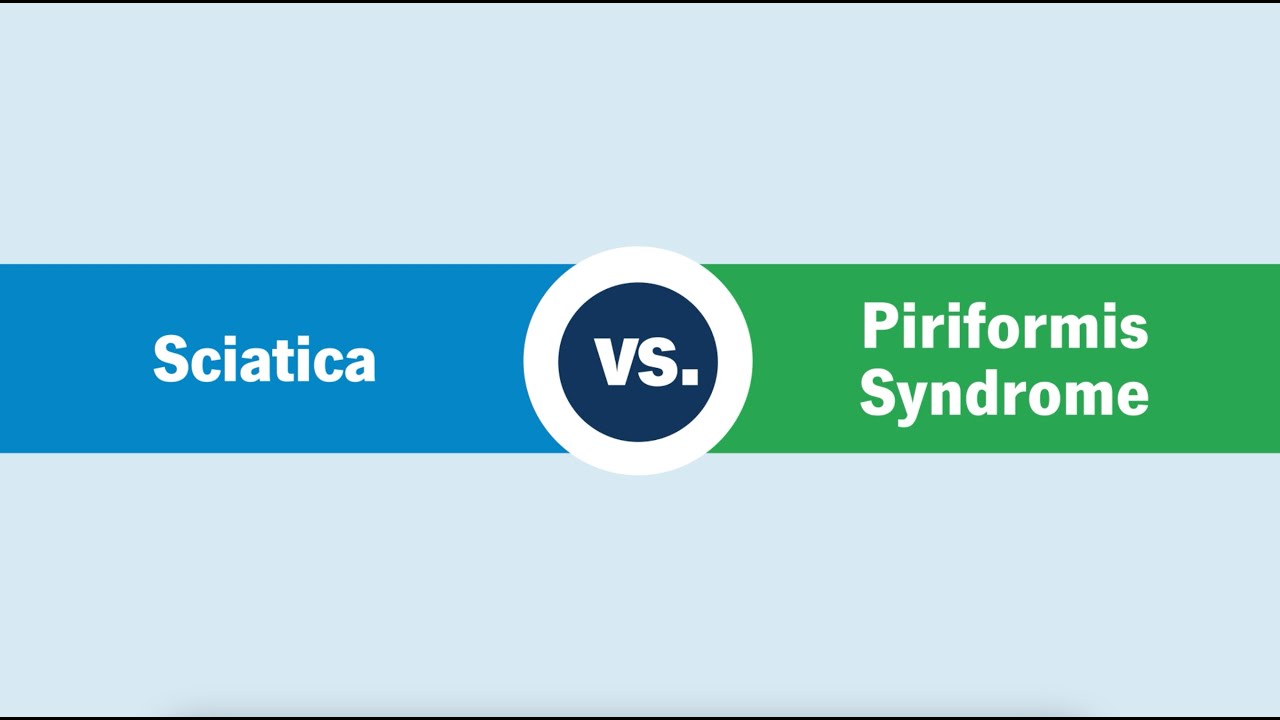 Sciatica vs. Piriformis Syndrome: What&rsquo;s the Difference?