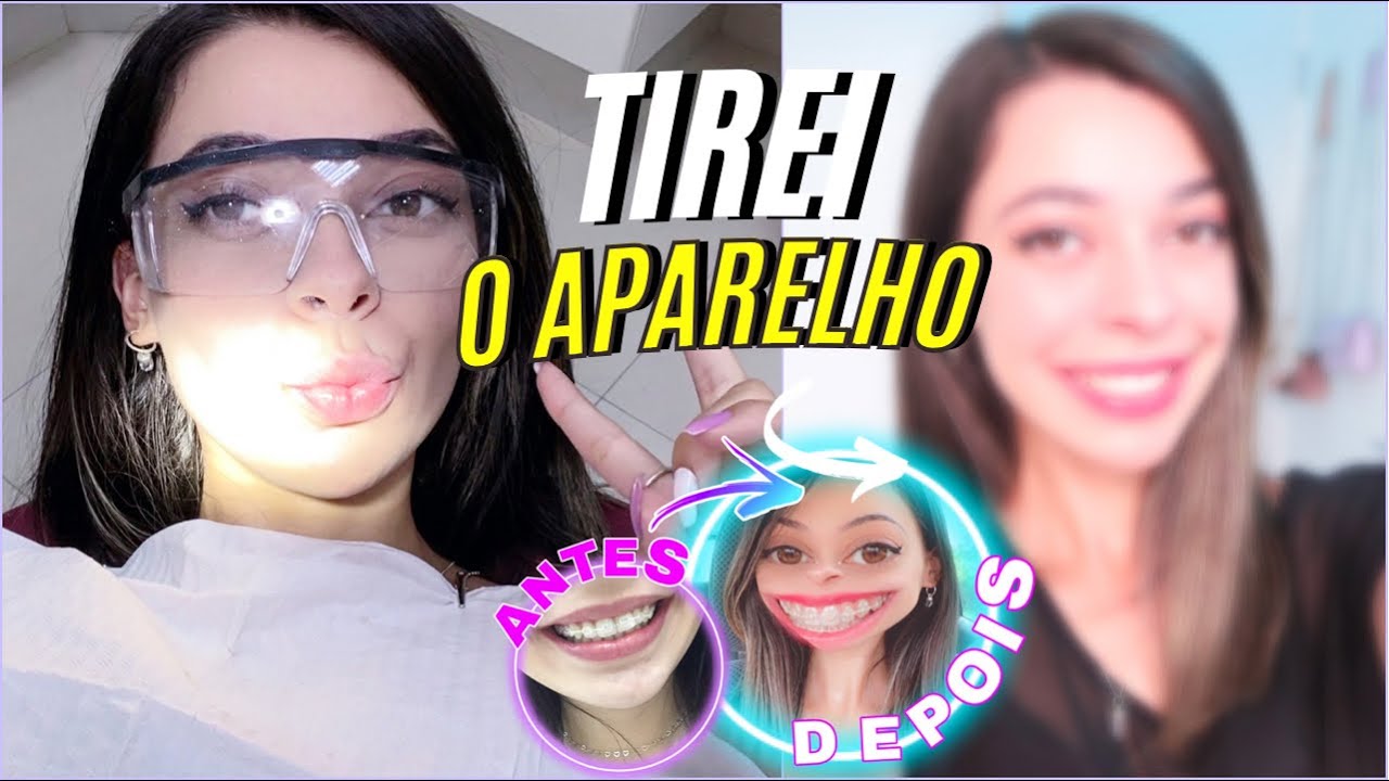 TIREI O APARELHO *depois de 2 anos* 🔥