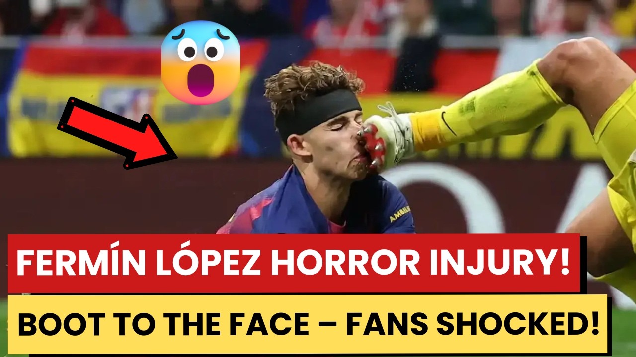 Fermin Lopez Injury Update - Ferm&iacute;n L&oacute;pez Suffers Horror Injury vs Atl&eacute;tico Madrid!