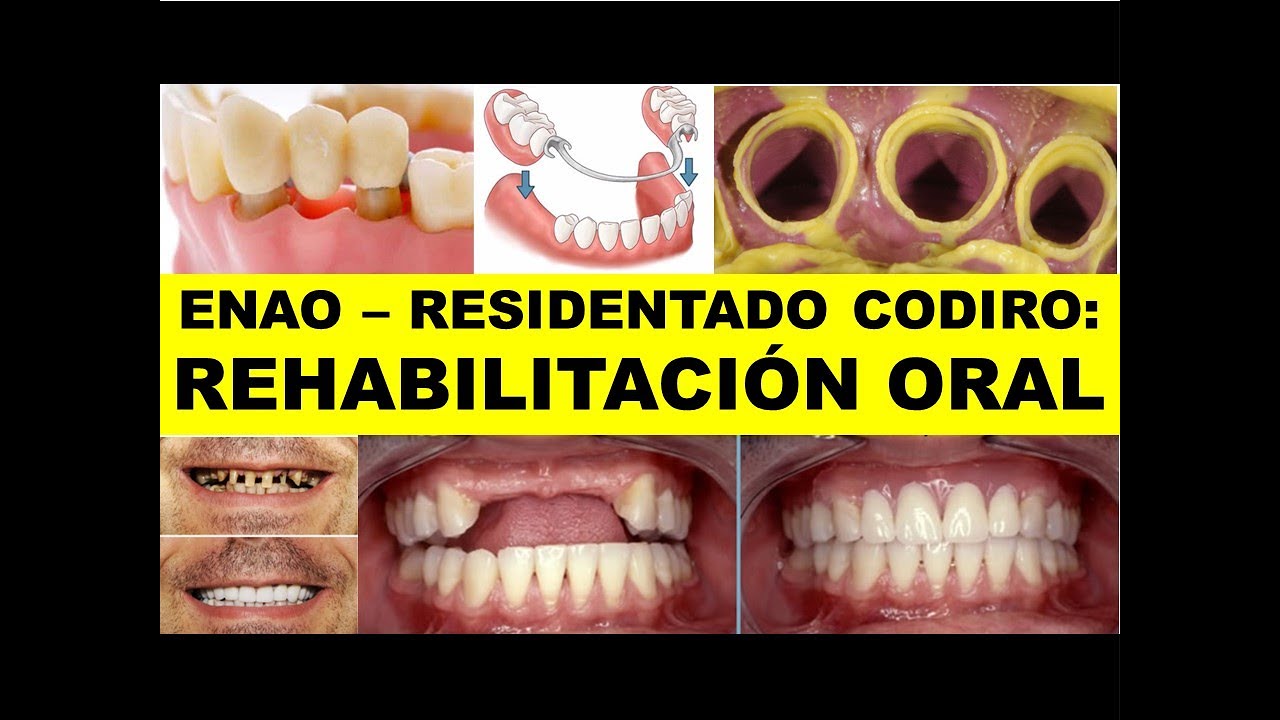ENAO - RESIDENTADO ODONTOLÓGICO:  