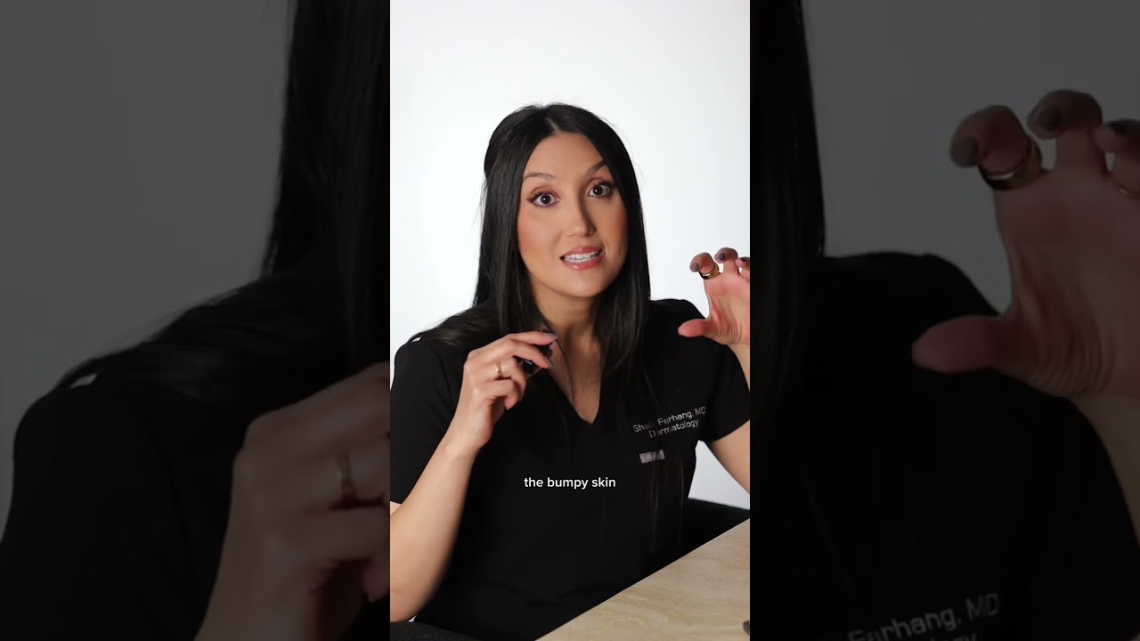 How To Get Rid of Bumpy & Textured Skin in 3 Easy Steps