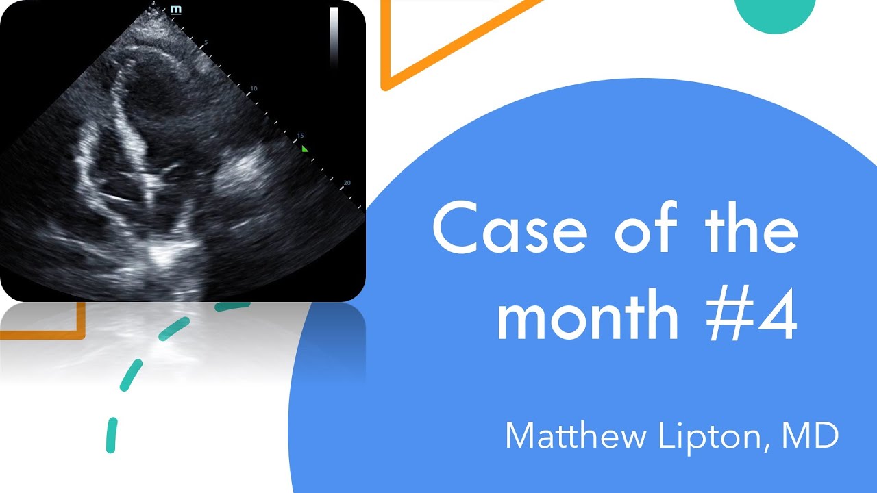 Case of the month #4