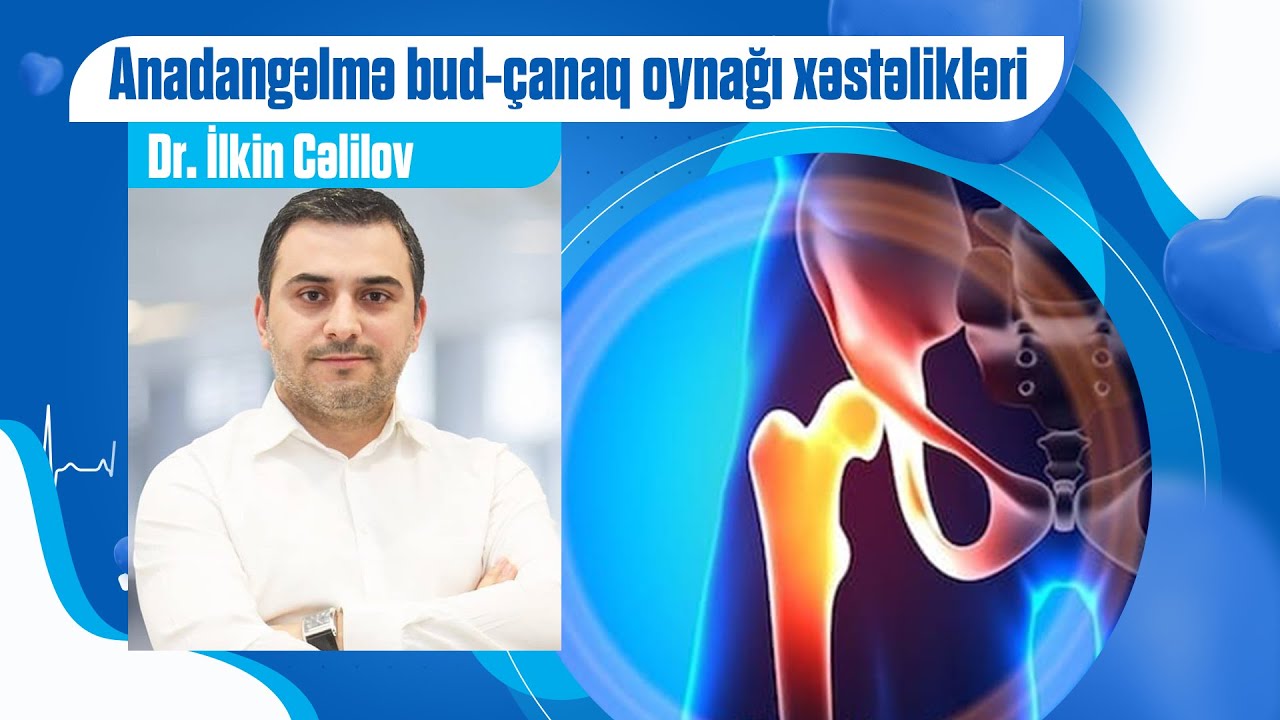 Anadangəlmə bud-çanaq oynağı xəstəliklərini necə müəyyən etmək olar?