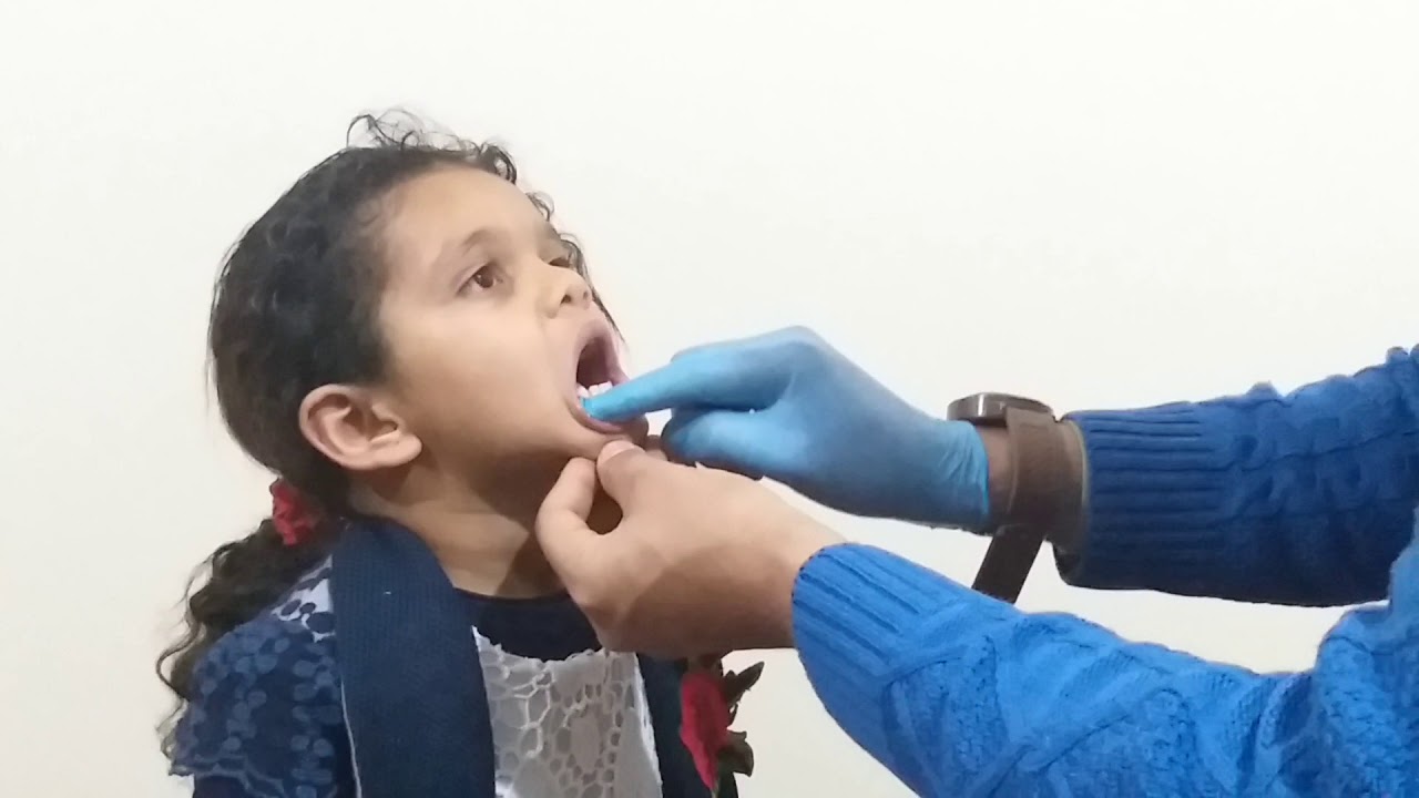تمارين عملية لتدليك اعضاء النطق والكلام مع منتصرالعيايدى