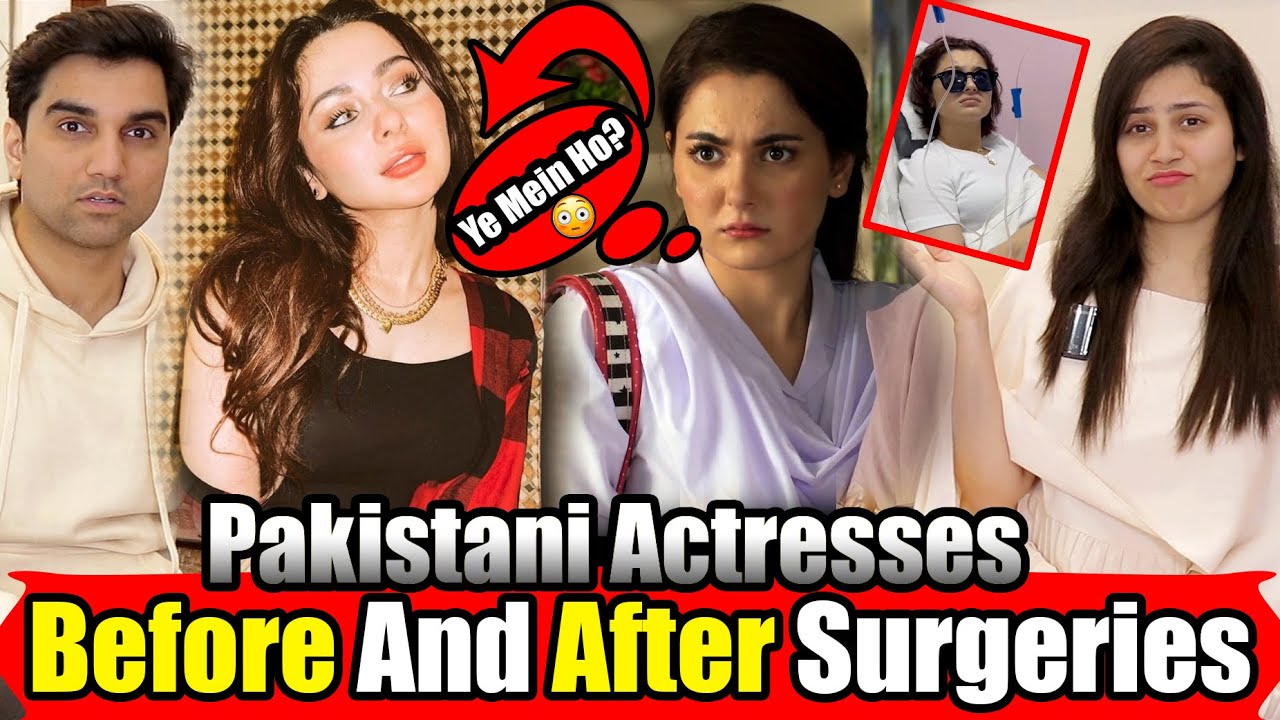 Pakistani Actresses: Shocking Transformations After Surgery! | The Bold Couple Ep 159 #Nomeej