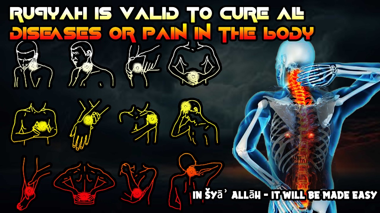 Ruqyah is valid for healing all illnesses or bodily ailments and peace of mind