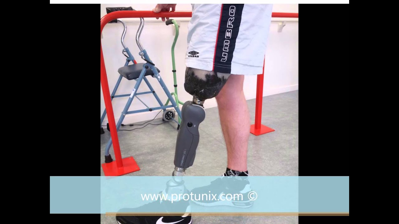 Prothèse fémorale équipée d'un Symbionic leg