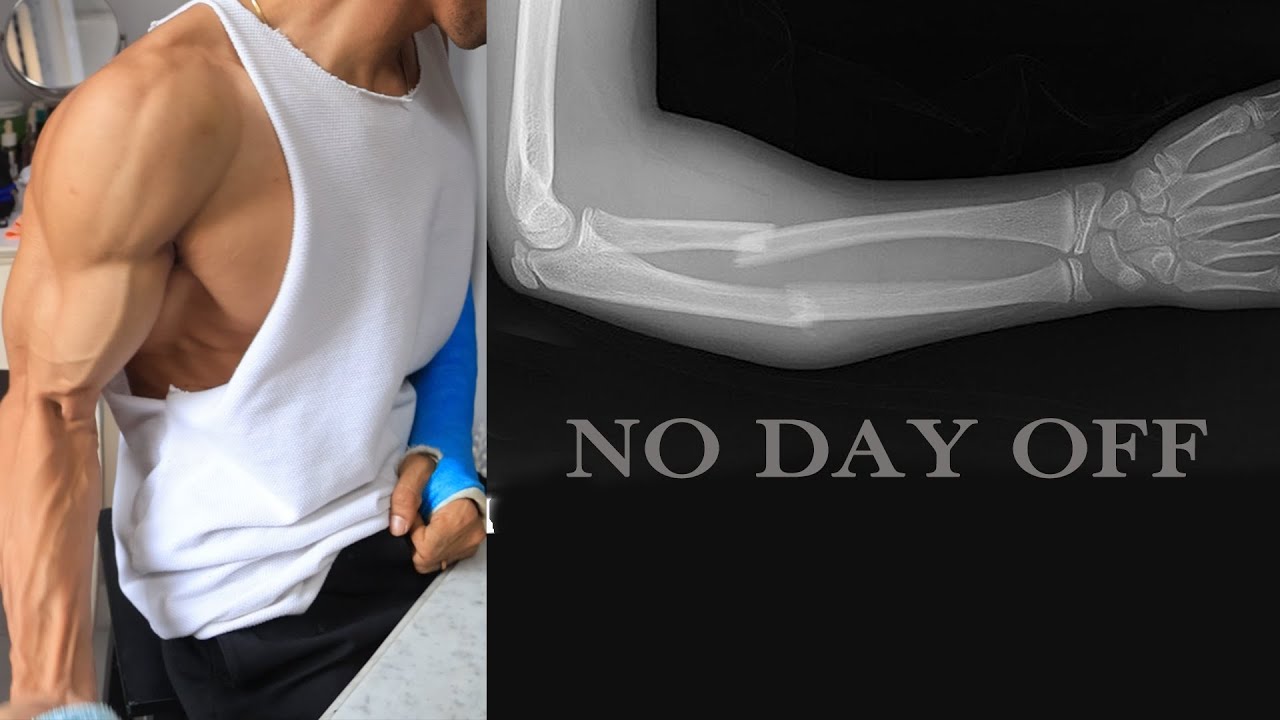 Doctor said no workout | Zen Addie