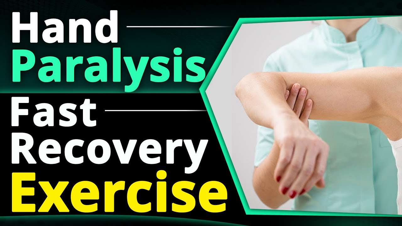 Hand Paralysis Fast Recovery Exercises | After Paralysis Hand Exercises | Dr. Pragti Gupta