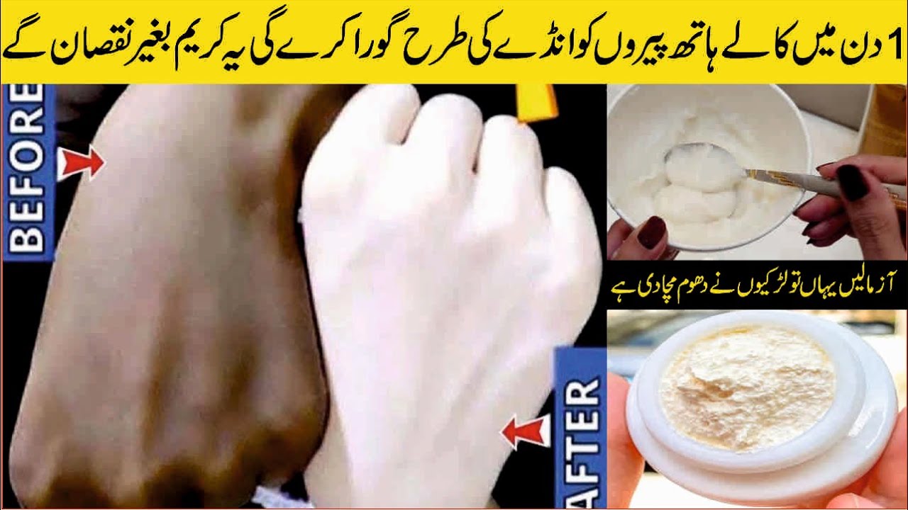 100% Secret Hand and Feet Whitening Cream | Hand Whitening Home Remedy | DIY Hand and Feet Whitening