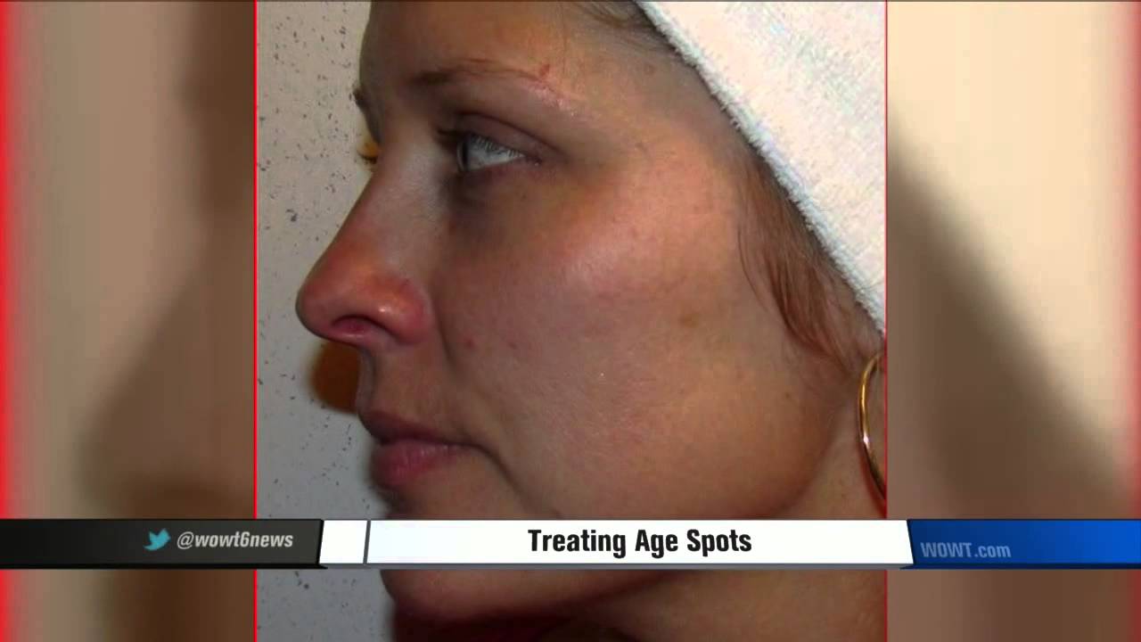 SchlessingerMD | #INTHEMEDIA - Dr. Joel Schlessinger featured on WOWT NBC Omaha