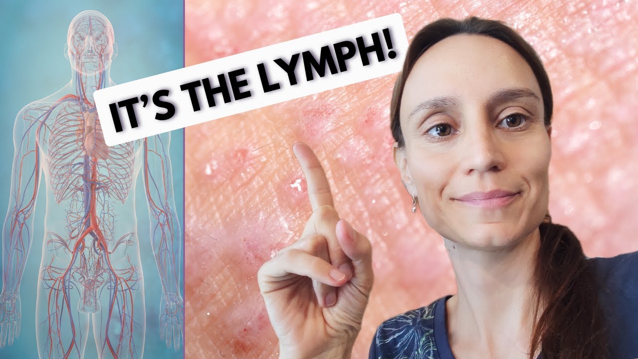 The True Cause of Eczema (It's Not a Skin Problem)
